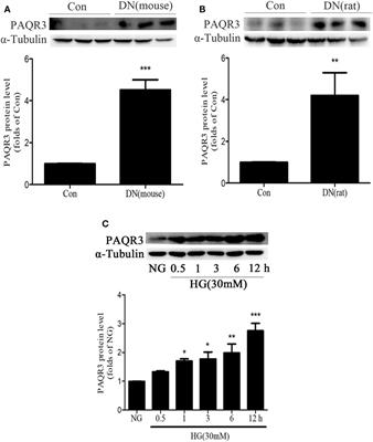 Progestin and AdipoQ Receptor 3 Upregulates Fibronectin and Intercellular Adhesion Molecule-1 in Glomerular Mesangial Cells via Activating NF-κB Signaling Pathway Under High Glucose Conditions